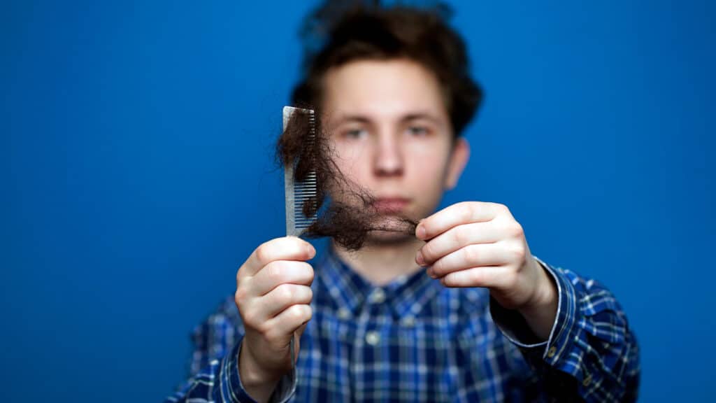 Ragazzo tira i capelli da un pettine a causa della perdita dei capelli