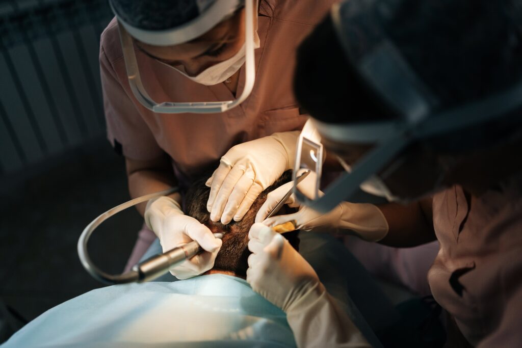 hair transplant in Turkey