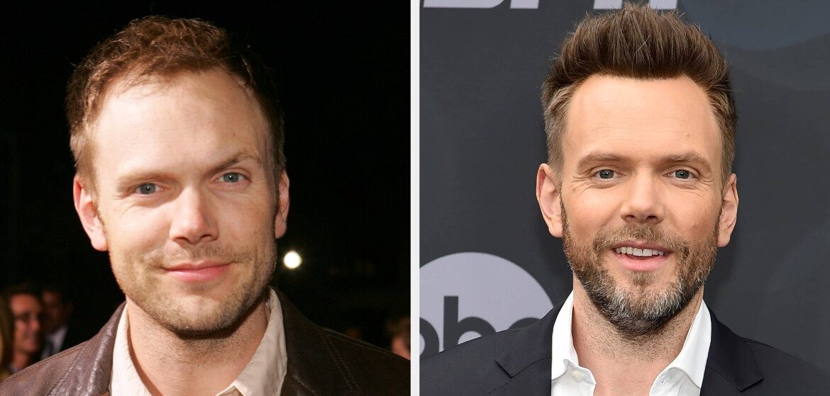 Side-by-side comparison of Joel McHale before and after his hair transplant