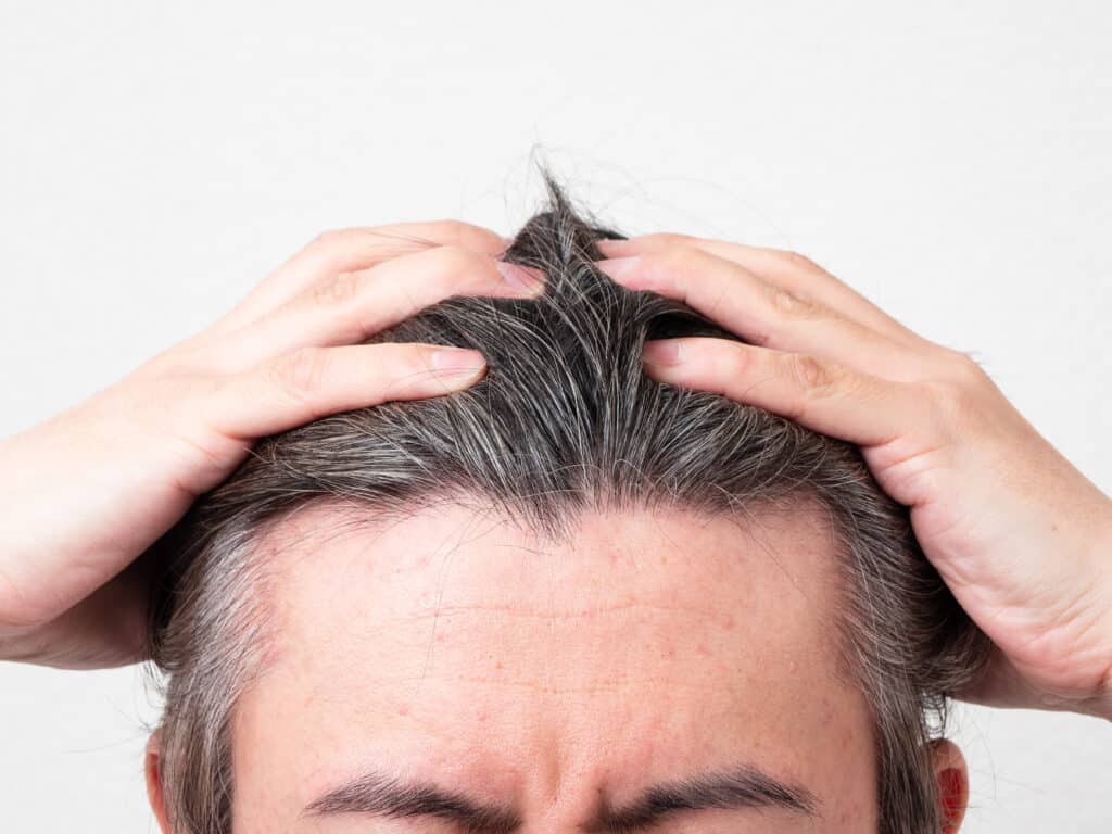 Uomo si tocca i capelli con le mani