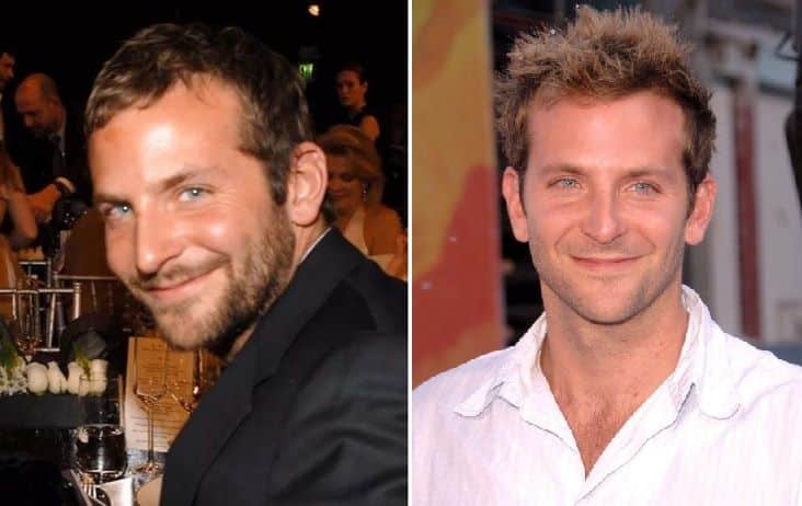Bradley Cooper showing early signs of hair thinning