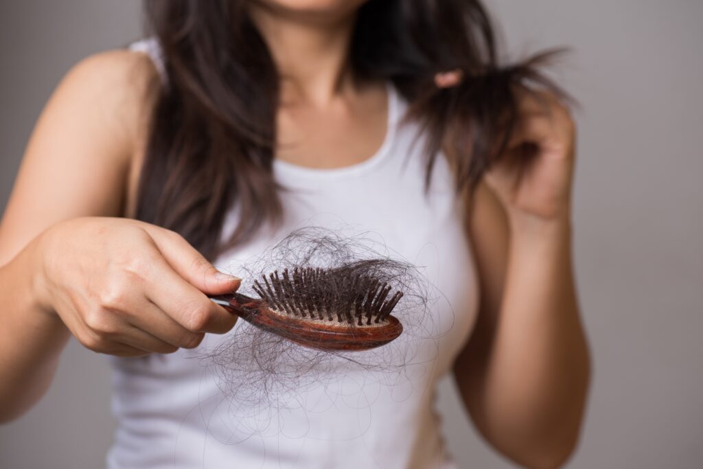Femme souffrant d'alopécie frontale fibrosante tenant une brosse pleine de cheveux tombés
