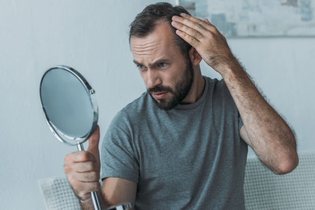 Homme souffrant de signes d'alopécie frontale fibrosante tenant se regardant dans un miroir
