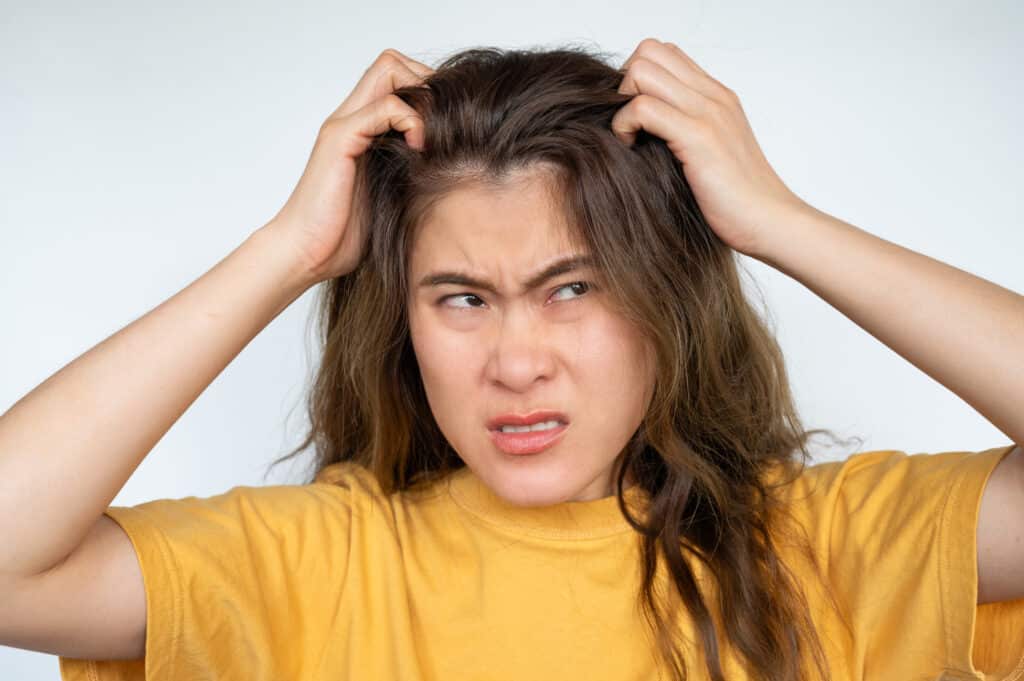 Mujer rascándose el cuero cabelludo a causa del picor. La caspa y una enfermedad inflamatoria de la piel llamada dermatitis seborreica son las causas más comunes del picor del cuero cabelludo.