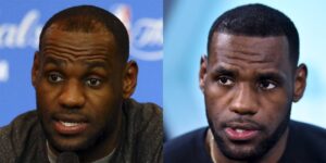 Image of Lebron james hair transplant before and after