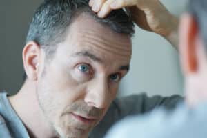 Uomo con stempiatura fisiologica si guarda allo specchio