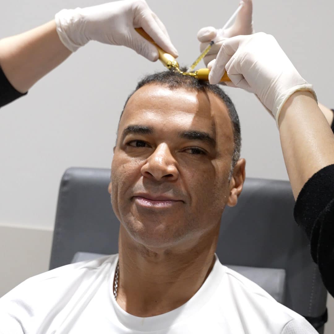 CAFU