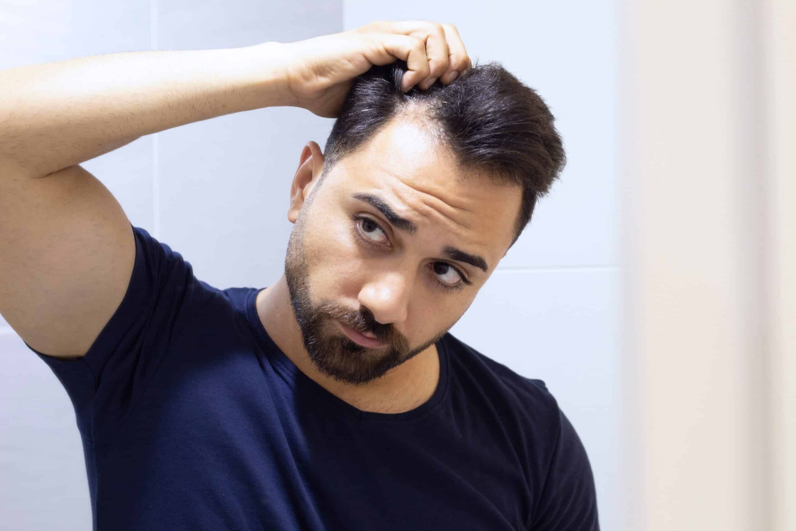 Homme observant ses cheveux après traitement au dutastéride cheveux