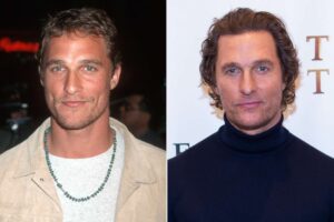 Matthew McConaughey Hair Transplant speculation during hair loss and recovery