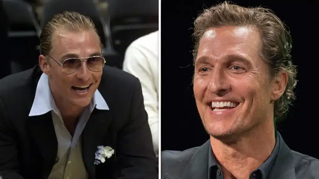 Matthew McConaughey Hair Transplant before and after hairline changes