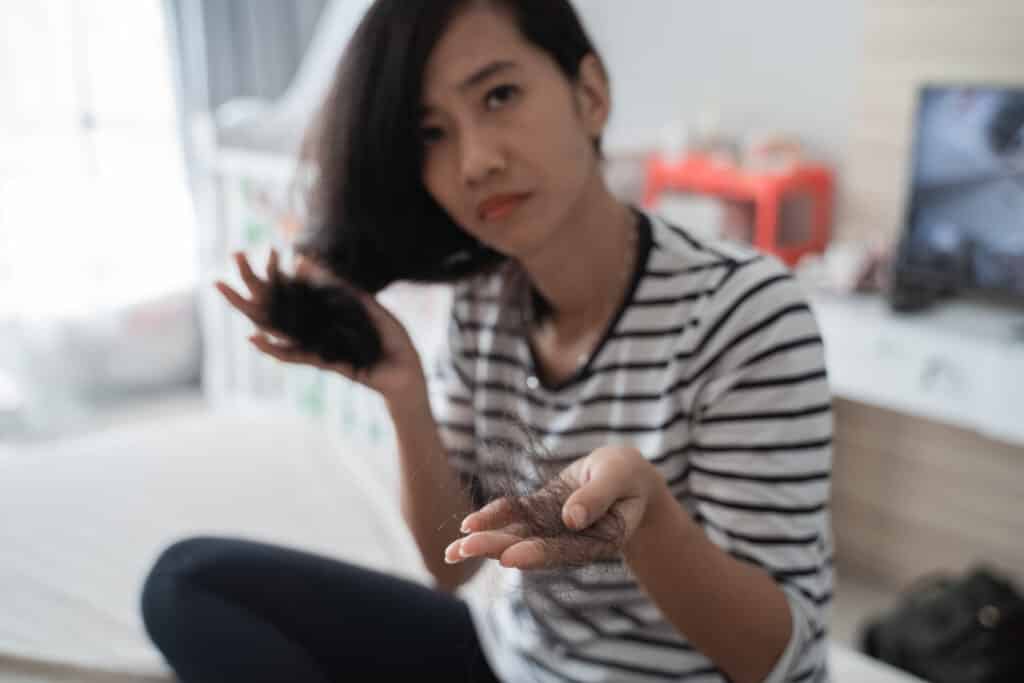Donna preoccupata per la perdita dei capelli mostra molti capelli persi tra le mani.