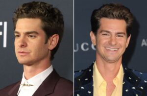 Photo of Andrew Garfield before and after a likely hair transplant
