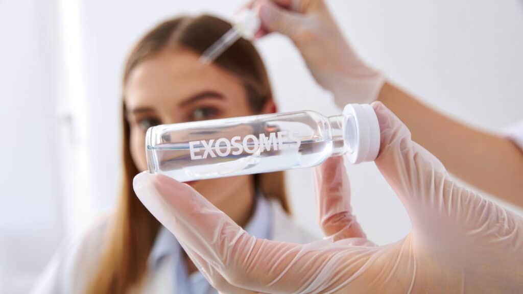 Exosome therapy for hair loss uses purified exosomes to stimulate hair follicle regeneration and reduce shedding