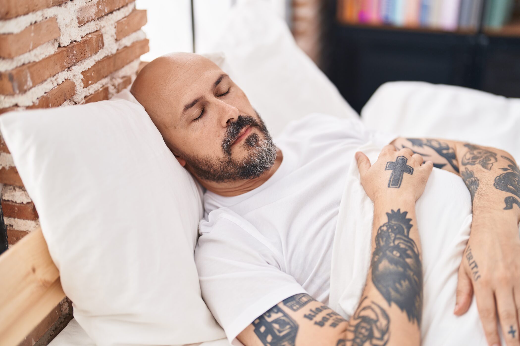 El hombre duerme después de un trasplante capilar.