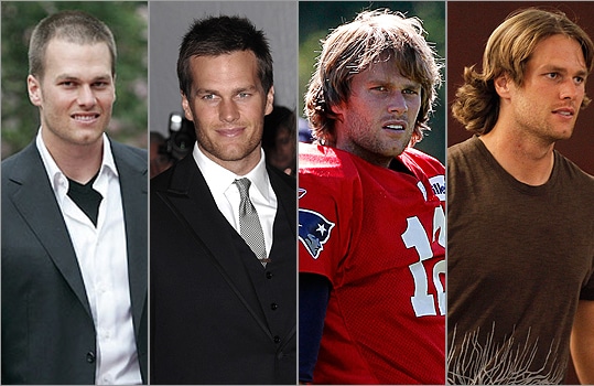 Tom Brady hair transplant journey