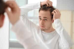 Hombre mirándose al espejo y preguntándose qué tipo de alopecia está desarrollando y si se trata de alopecia por tracción.