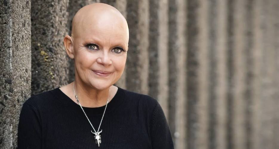 Gail Porter’s completely bald head stands as a powerful statement of acceptance and advocacy