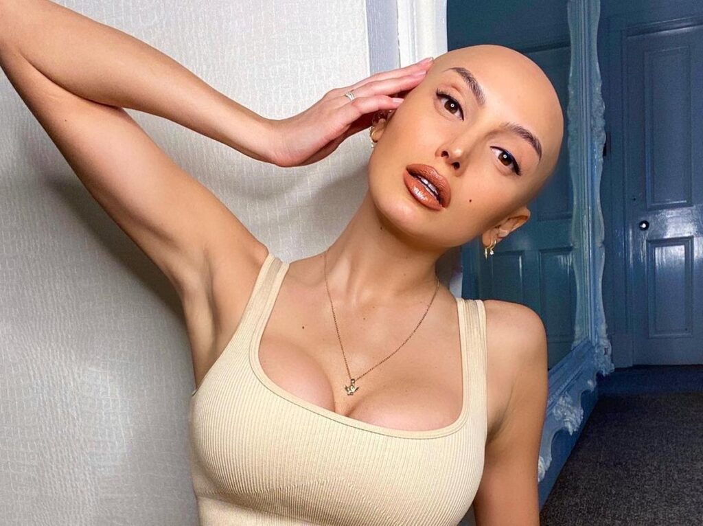 ZaraLena Jackson’s bald look stands as a reminder of inner strength and self-acceptance