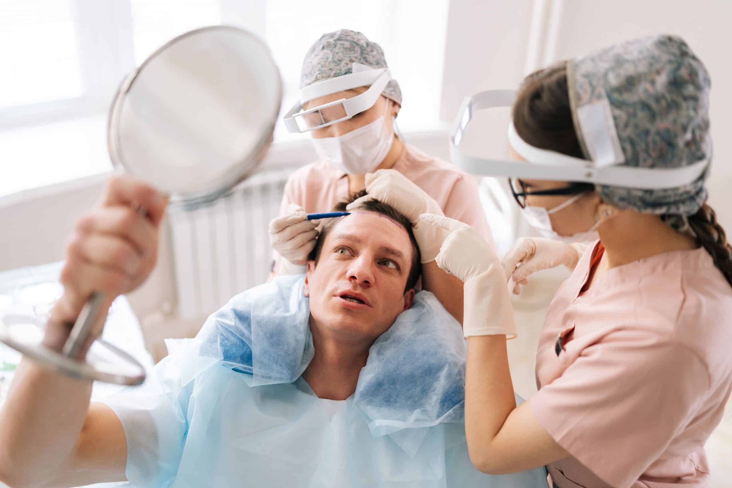 Wszystkie nurtujące pytania dotyczące przeszczepu włosów