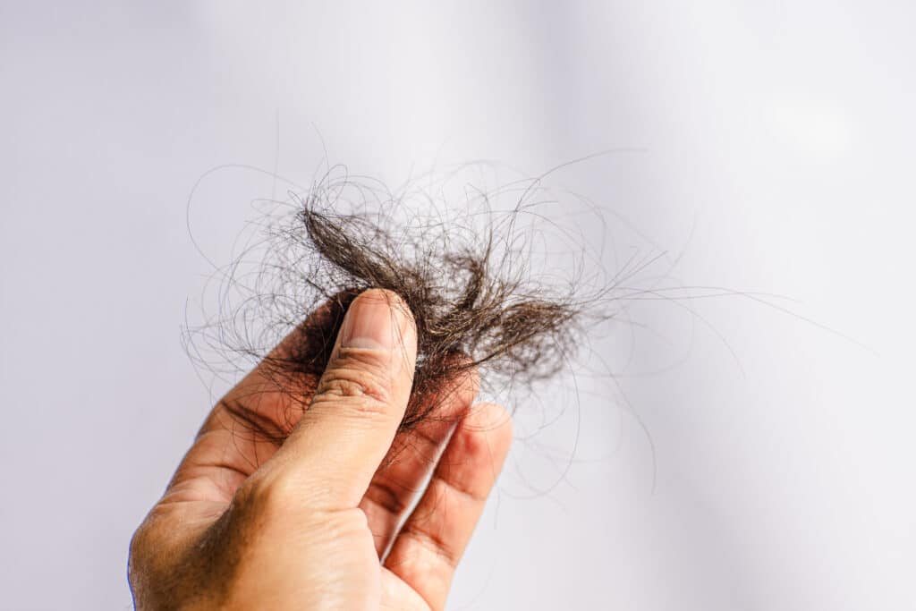 Cabello perdido en la mano