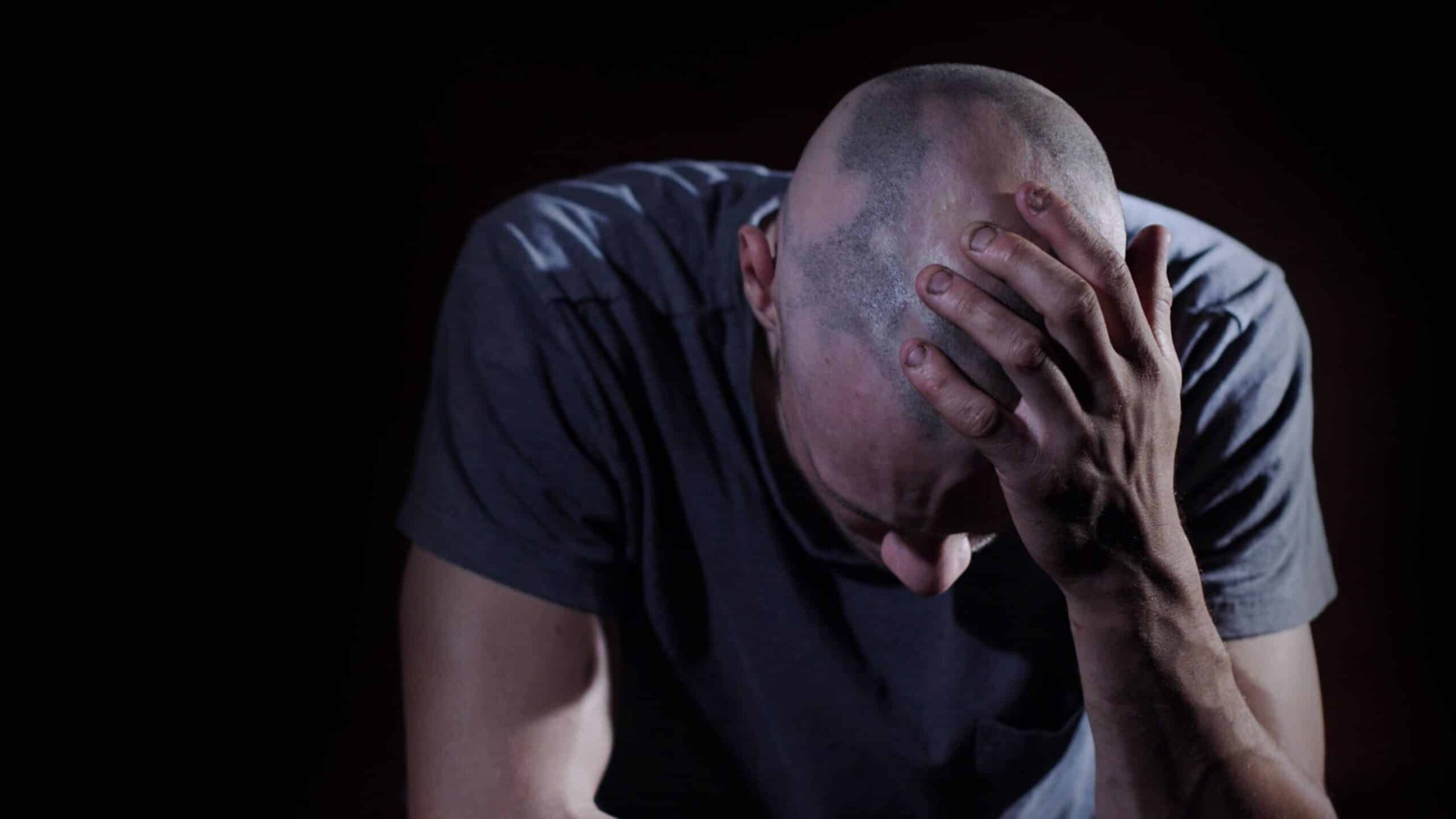 Hombre con alopecia cicatricial