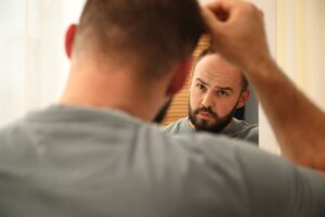 Uomo controlla la propria fronte alta allo specchio
