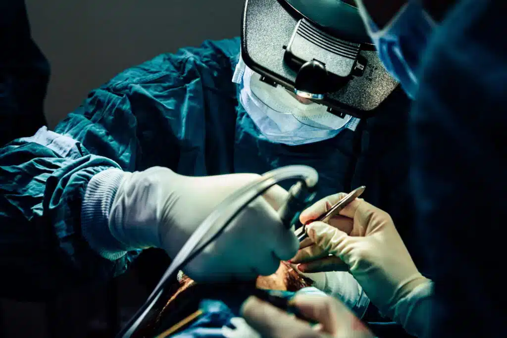 Los médicos están trabajando en un procedimiento para un trasplante capilar de 3000 folículos