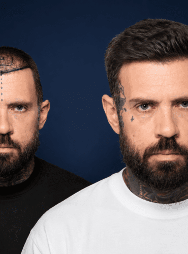 4000-grafts-hair-transplant-adam22-cosmedica
