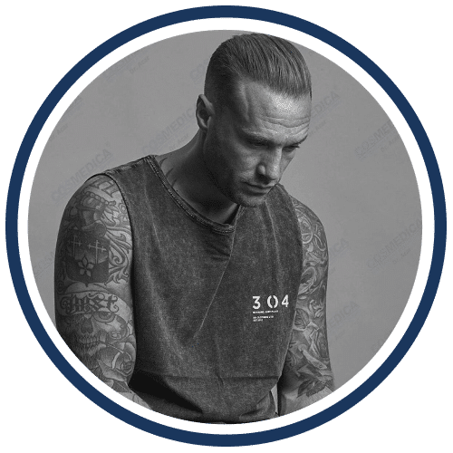 Calum Best po zabiegu przeszczepu włosów