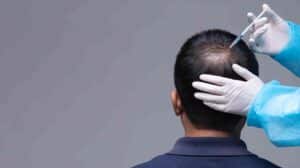 Un médecin injecte une seringue dans les cheveux