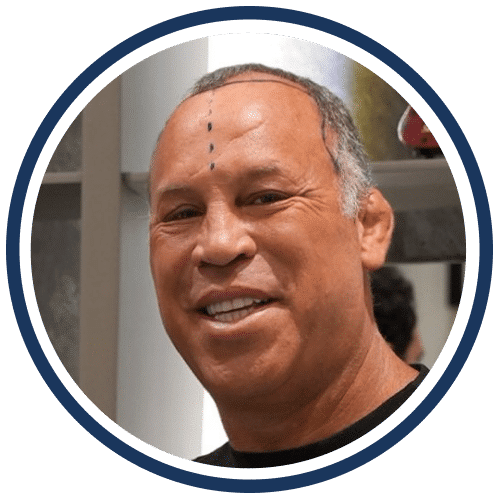 Wanderlei Silva w klinice Cosmedica