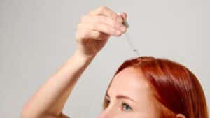 Donna usa gocce a base di clascoterone per i propri capelli