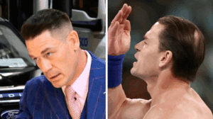 John Cena Hair Transplant Before and After