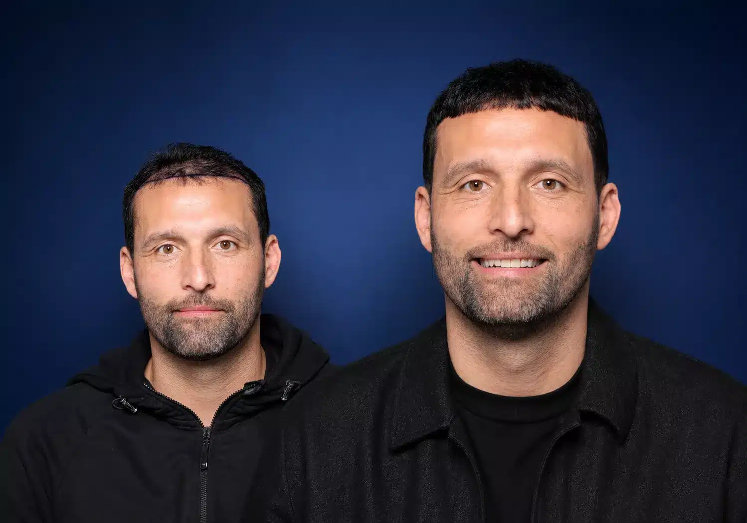 Kevin Kuranyi vor und nach seiner Haartransplantation bei Cosmedica