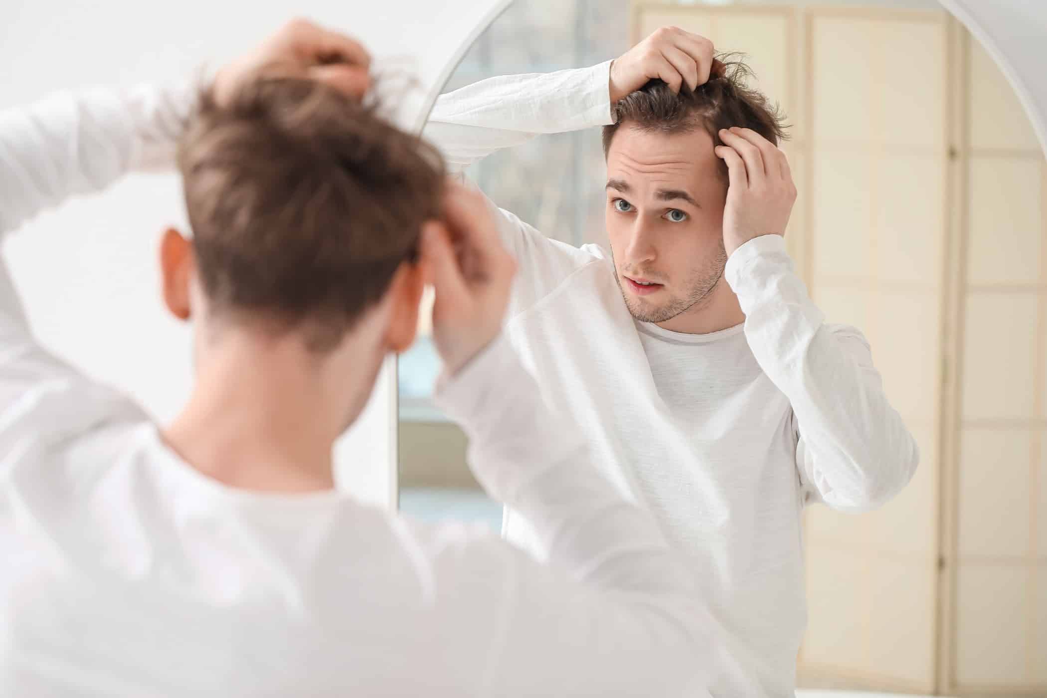 Uomo con possibile alopecia androgenetica che controlla il diradamento dei capelli allo specchio