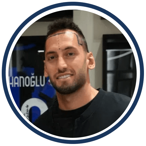 Hakan Çalhanoğlu