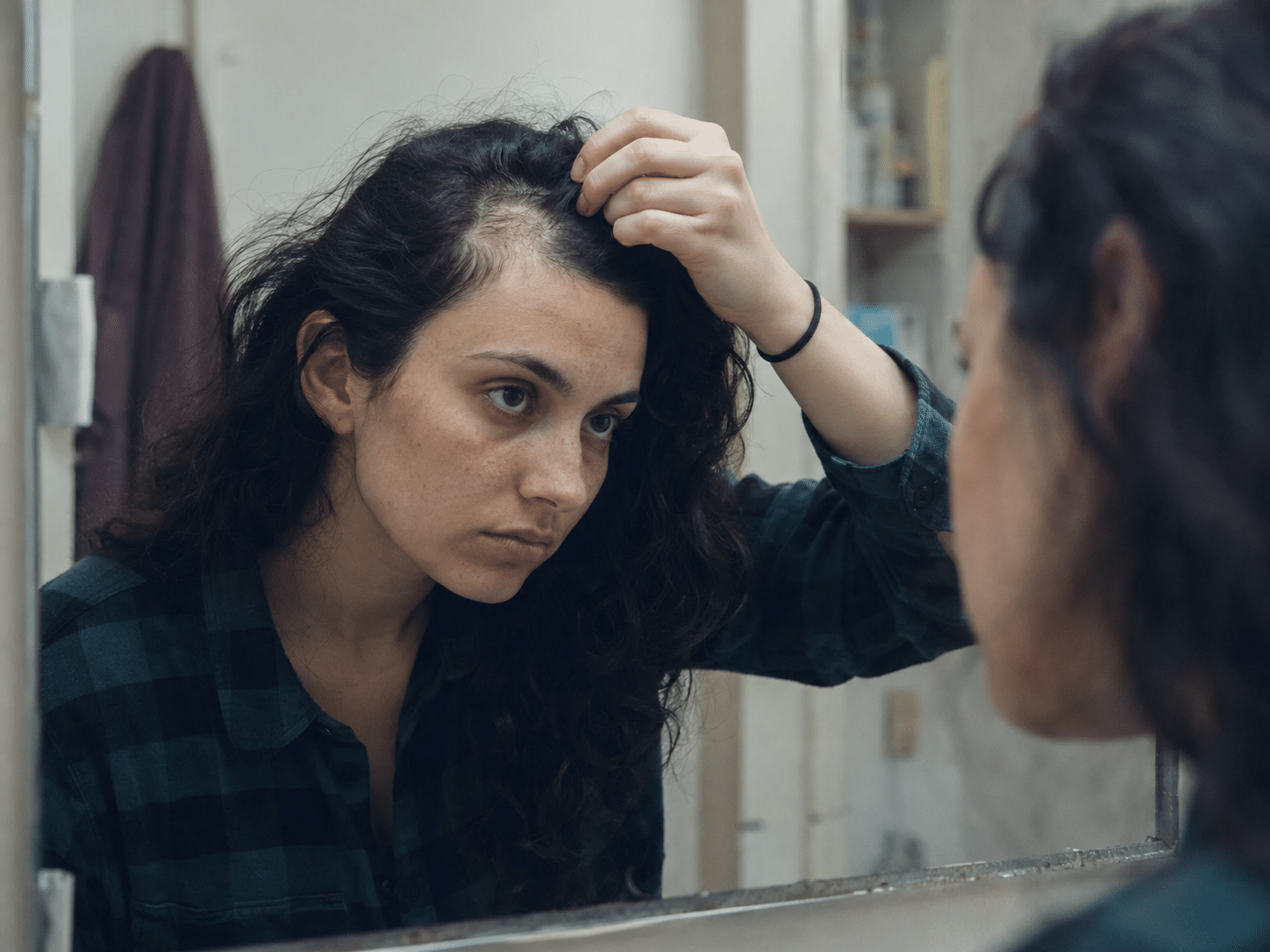 Femme observant une zone d’alopécie irrégulière liée à la trichotillomanie devant un miroir