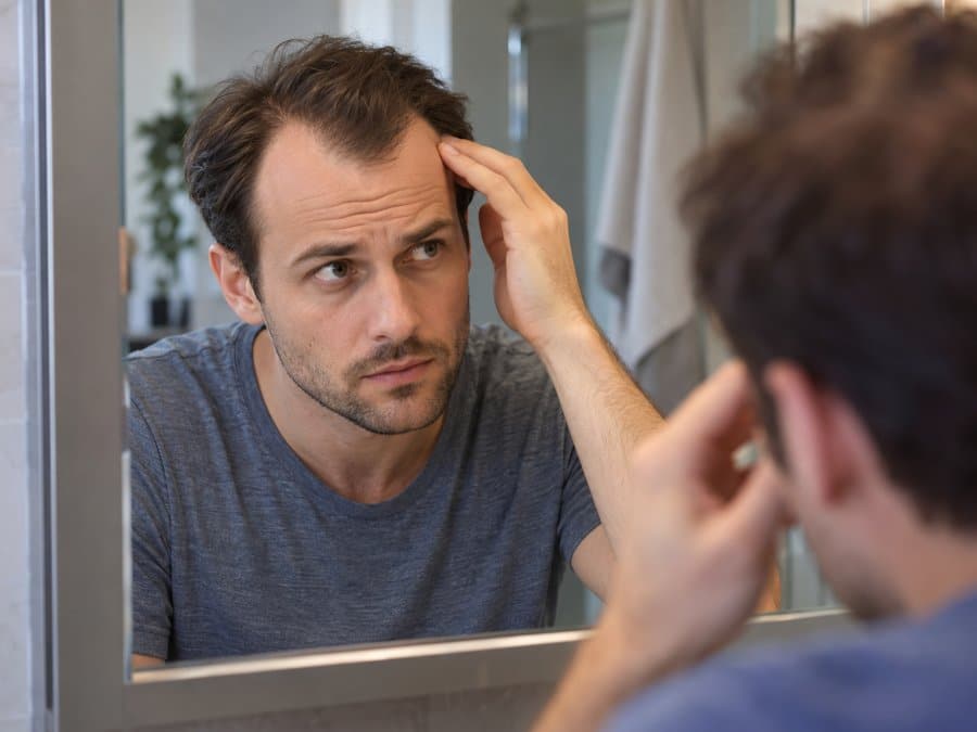 Man bekijkt zijn haarlijn in de spiegel op tekenen van Norwood 3