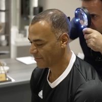 Cafu consultation before hair transplantation in Turkey