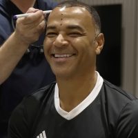 Cafu hair line before hair transplantation