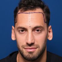 Çalhanoğlu-1