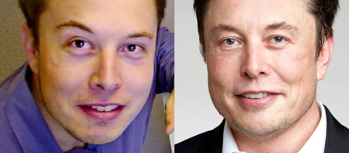 Elon Musk Saç Ekimi - Dr. Levent Acar