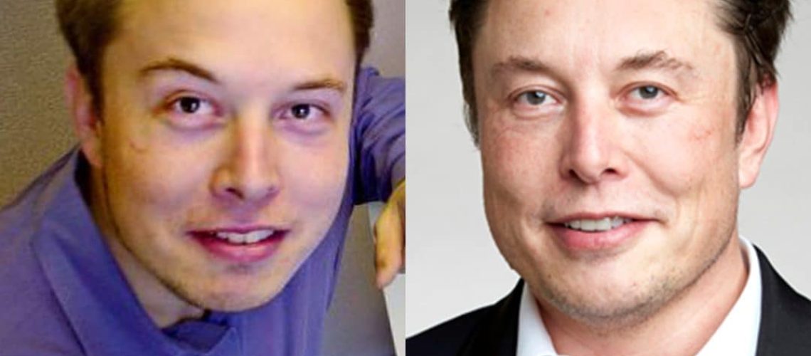 Elon Musk cheveux