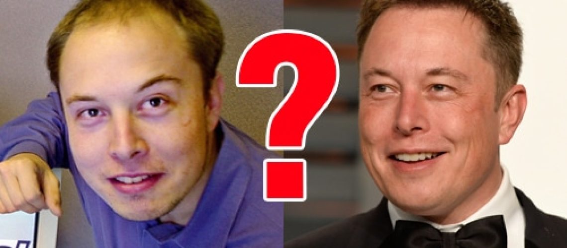 Foi-Elon-Musk-na-verdade-um-transplante-de-cabelo
