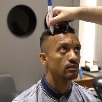 Image of Portuguese football player Nani during his hair analysis at Cosmedica Clinic with Dr Levent Acar