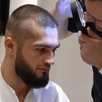 Picture of Hair analysis of Professional MMA Fighter Rustam Serbiev at Cosmedica Clinic with Dr Levent Acar