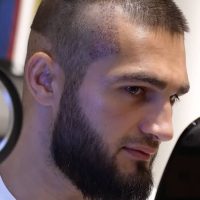 Professional MMA Fighter Rustam Serbiev right after his hair transplant in Turkey at Cosmedica Clinic