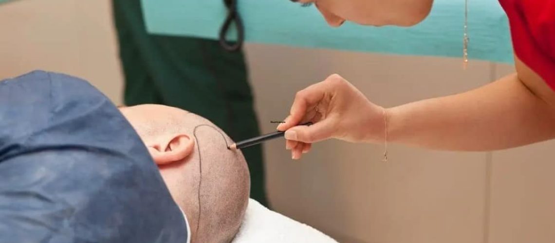 Pielęgniarka rysuje linię włosów u leżącego tyłem pacjenta