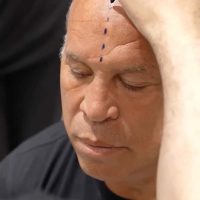 Professional MMA fighter Wanderlei Silva during his hair transplant consultation at Cosmedica Clinic