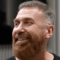 Photo of DJ Vlad before his hair transplant in Turkey at Cosmedica Clinic